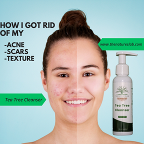 Tea Tree Cleanser